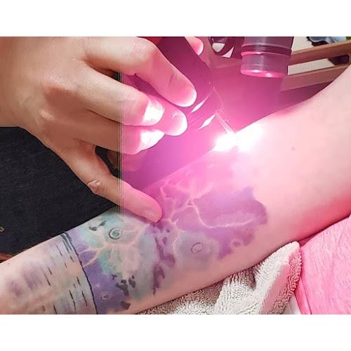 Vanish Skin Aesthetics and Laser Tattoo Removal
