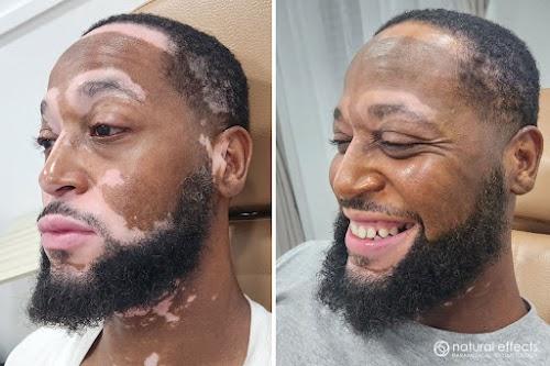 Natural Effects Medical Tattooing